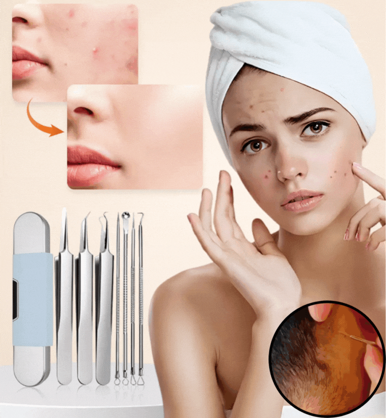 💆‍♀️Αντιβακτηριδιακό σετ αφαίρεσης φαγεσώρων από ανοξείδωτο ατσάλι με αφαίρεση μαύρων στιγμάτων και τσιμπιδάκι για τα κύτταρα ακμής
